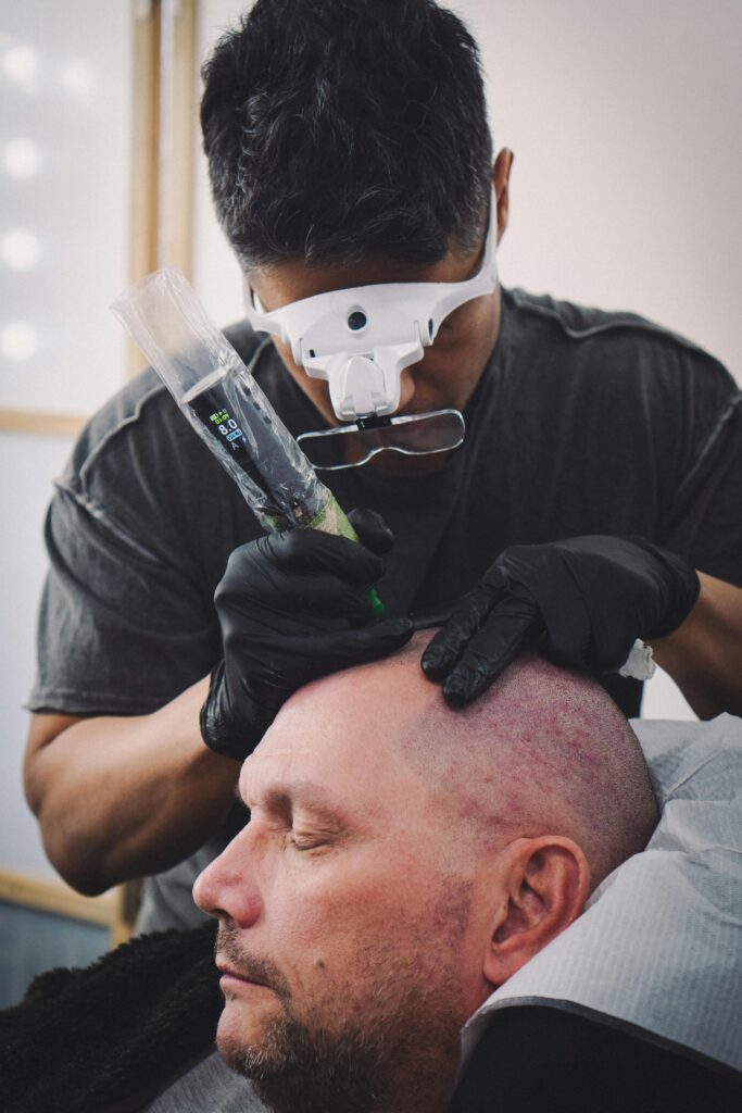 A skilled tattoo artist performing scalp micropigmentation on a client's head.